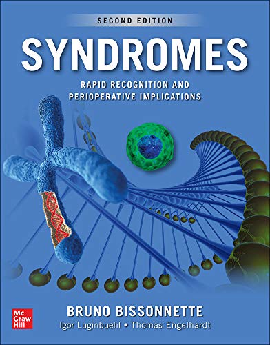 Syndromes Rapid Recognition And Perioperative Implications