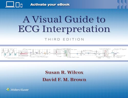 visual-guide-to-ecg-interpretation-stanzatextbooks